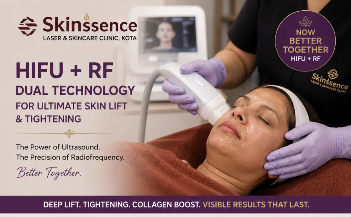 10 Facts About HIFU Treatment in Kota Every Patient Should Know (2026) - Skinssence Kota