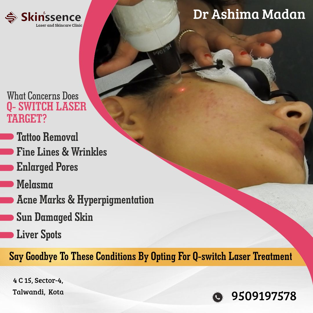 Combating Stubborn Melasma with Low-Level Laser Therapy (LLLT)