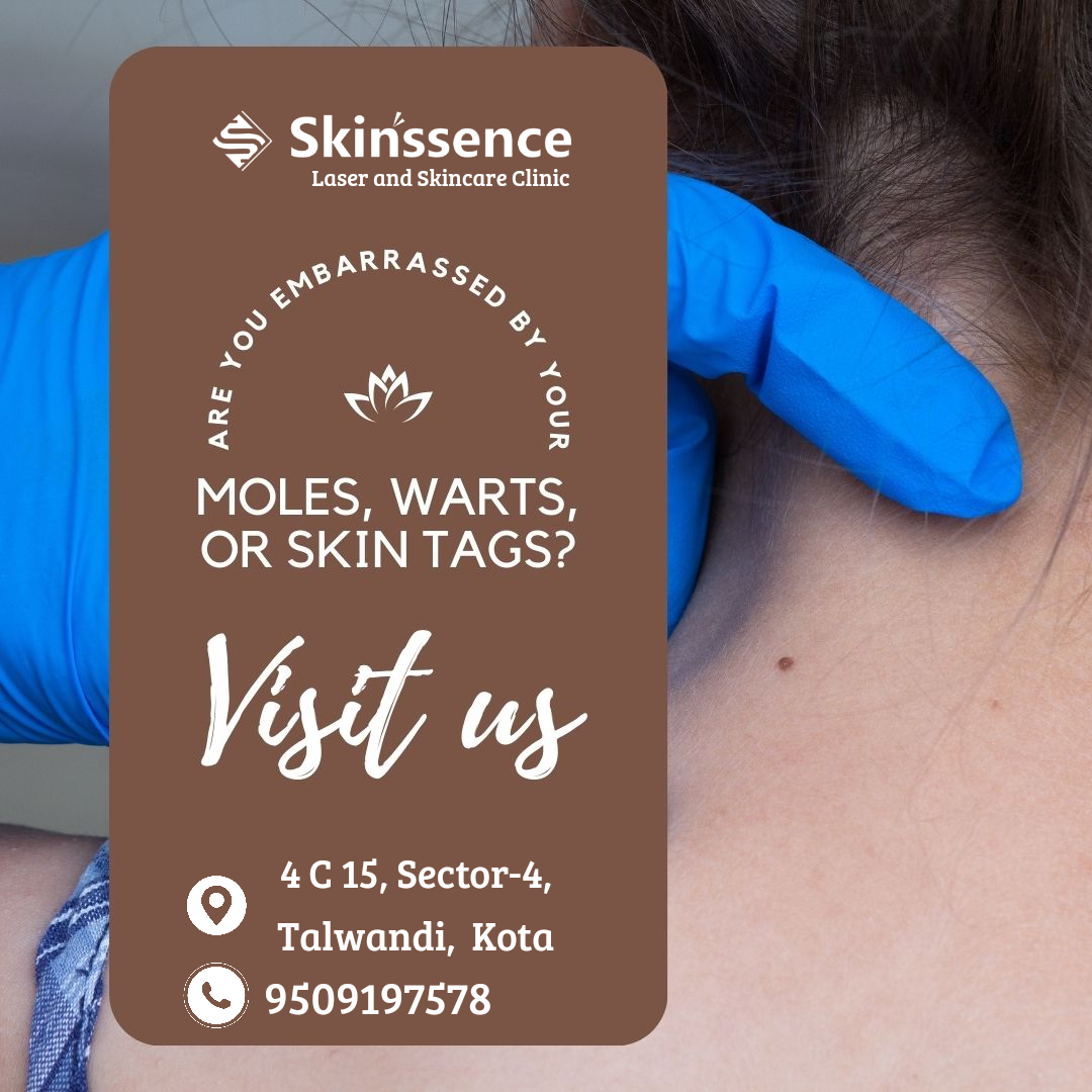 How to find write skincare specialist and cosmetologist in Kota?