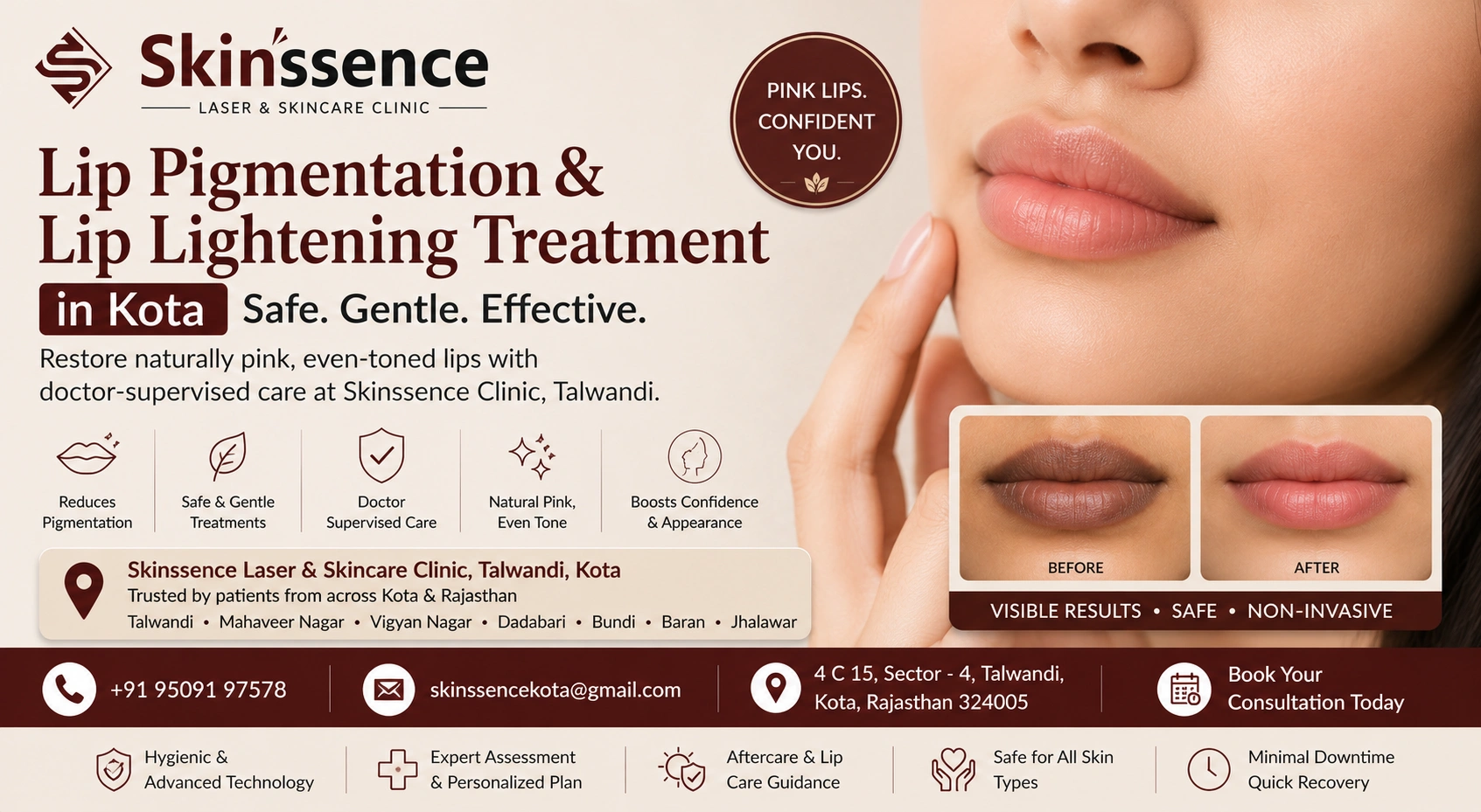 Smoker's Lips, Dark Lips & Uneven Lip Tone — Dermatologist-Led Treatment at Skinssence, Talwandi at Skinssence Laser and Skincare Clinic, Talwandi, Kota