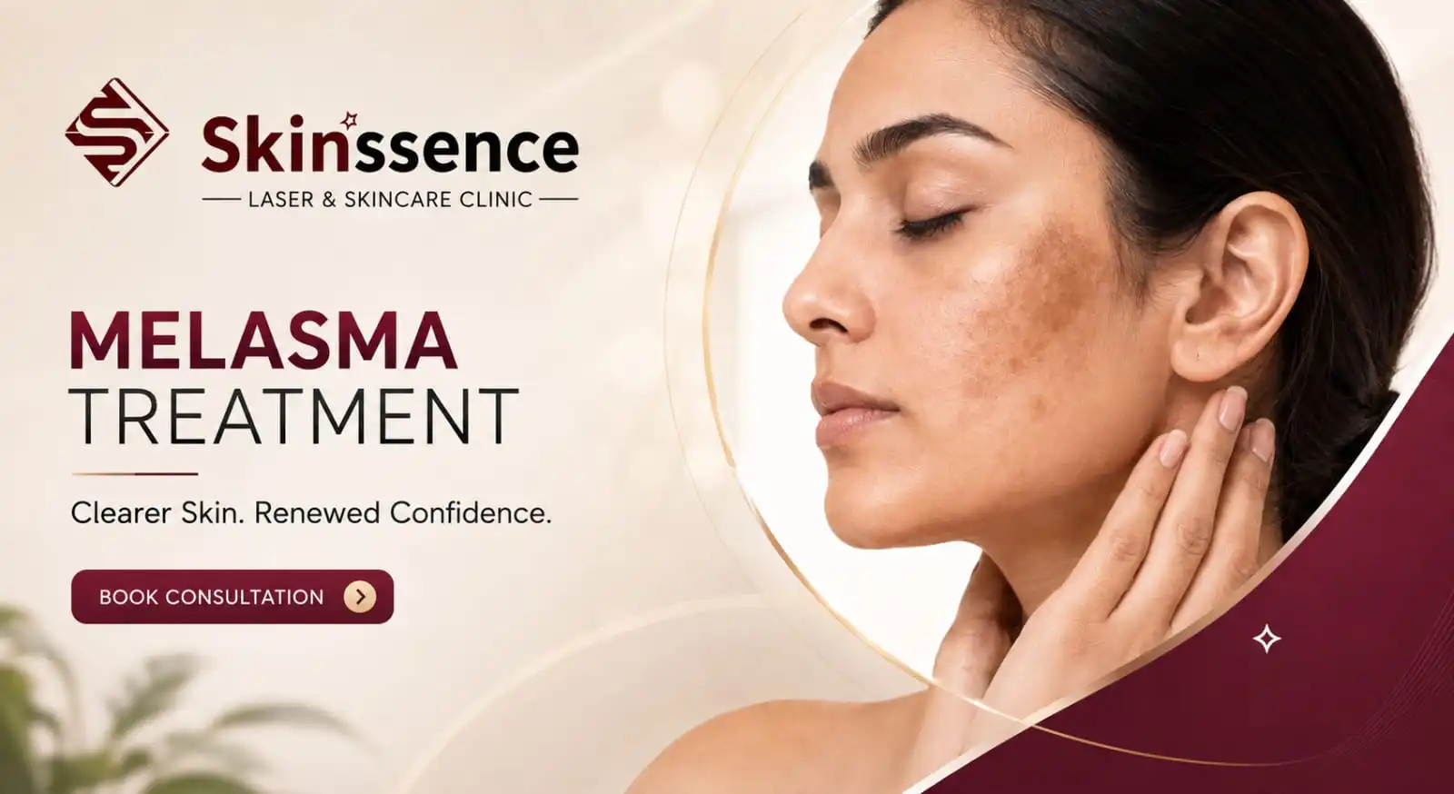 Q-Switch Laser Pigmentation Treatment Kota